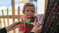 A young girl in Gaza is screened for signs of malnutrition.
